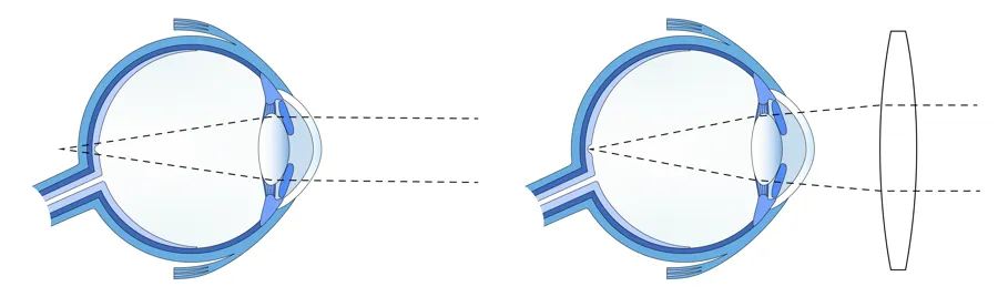 Sunburst-diagram