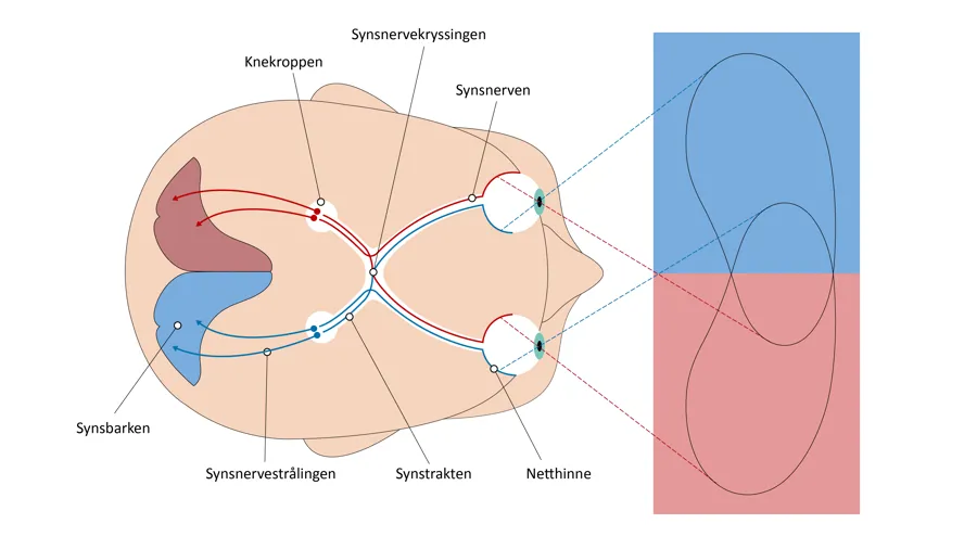 Diagram, radardiagram