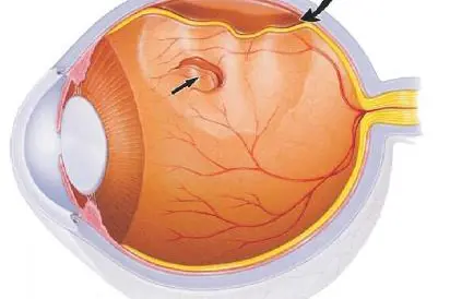 Anatomisk bilde av øye