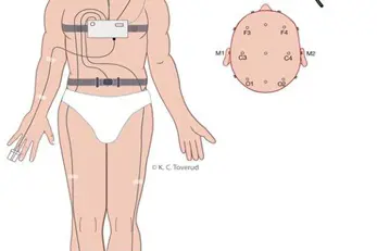 Illustrasjon av kropp med elektroder for søvnmåling på fingre, bryst og hode.